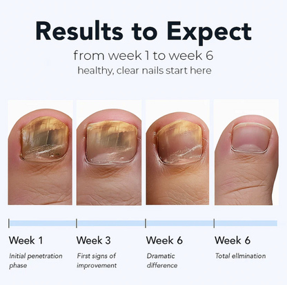 Fungal Fix - Fungal Nail Renewal Patches
